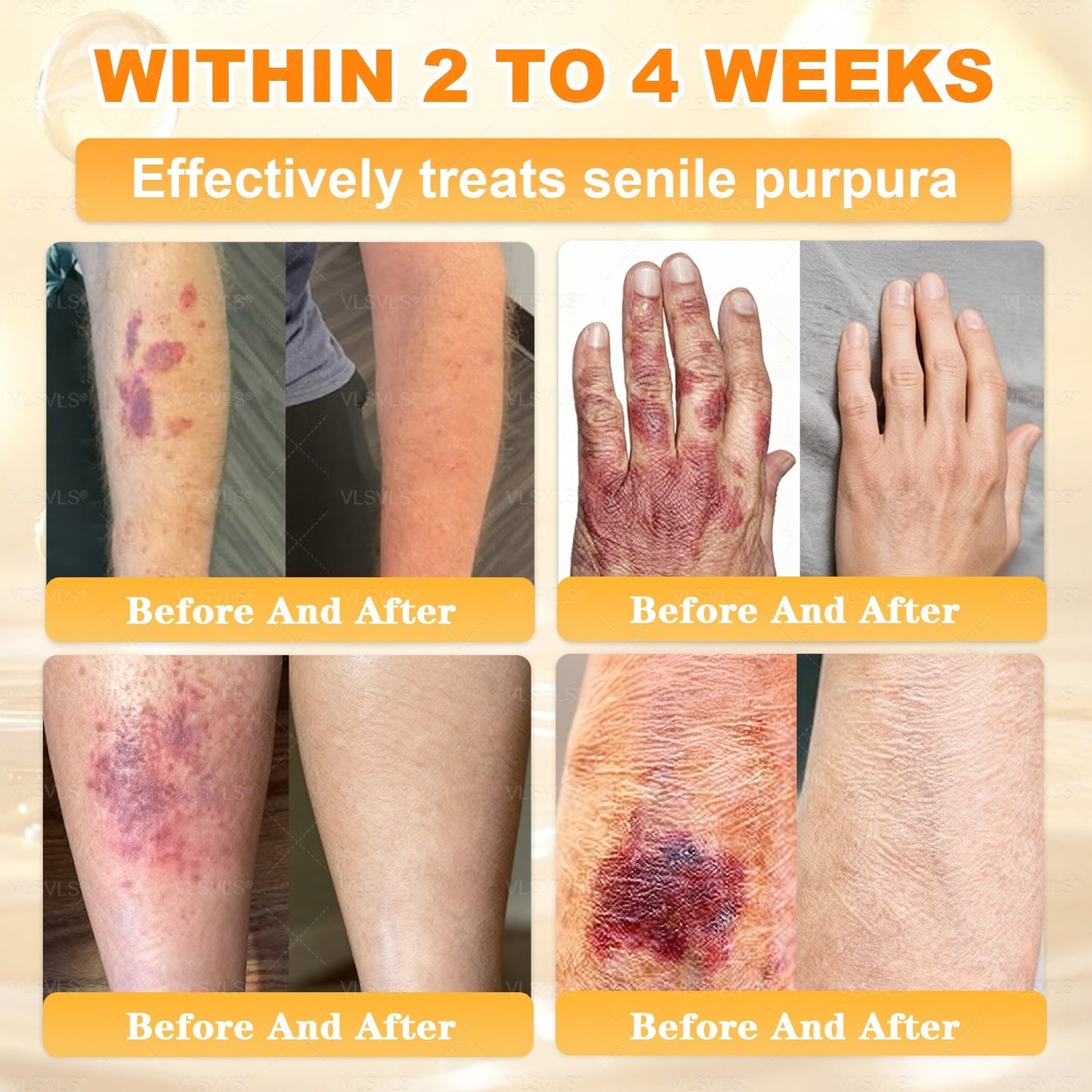 💐 Cavebit® Bee Venom Cream – Fast Skin Repair | Made in USA | 80% OFF!