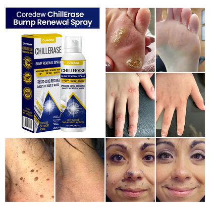 Coredew® ChillErase Bump Renewal Spray