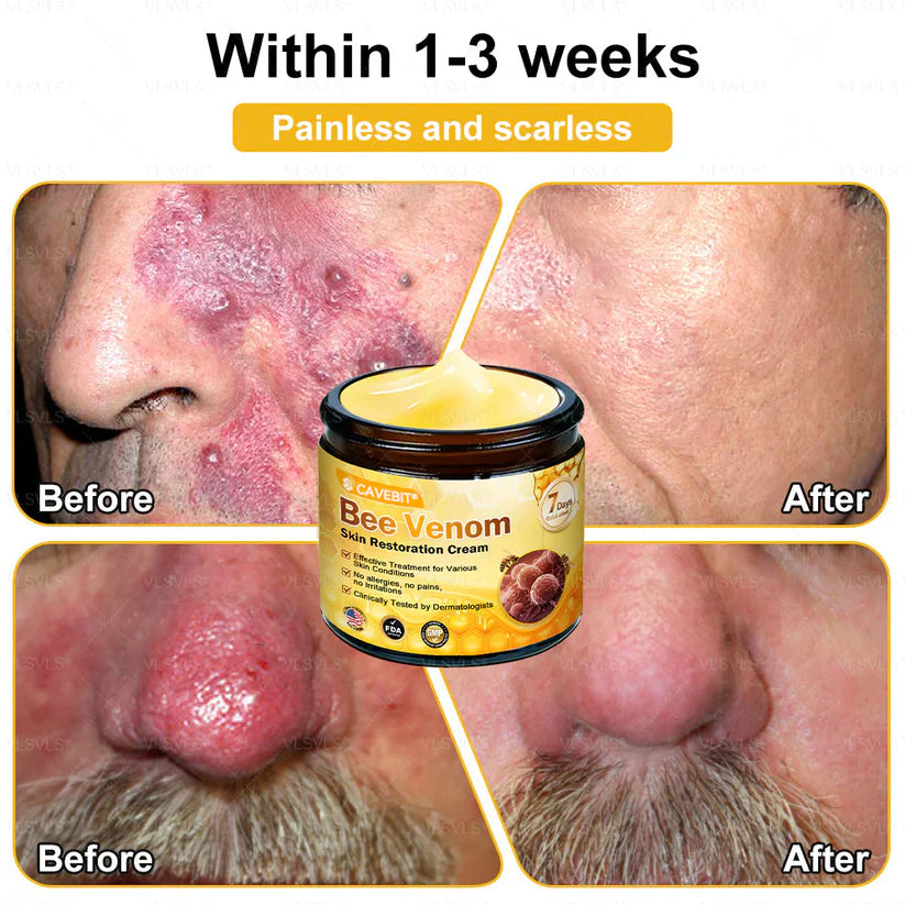 💐 Cavebit® Bee Venom Cream – Fast Skin Repair | Made in USA | 80% OFF!