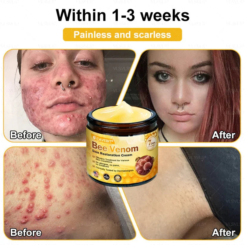 💐 Cavebit® Bee Venom Cream – Fast Skin Repair | Made in USA | 80% OFF!