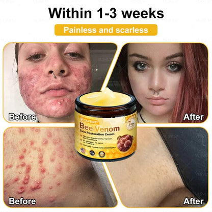 💐 Cavebit® Bee Venom Cream – Fast Skin Repair | Made in USA | 80% OFF!