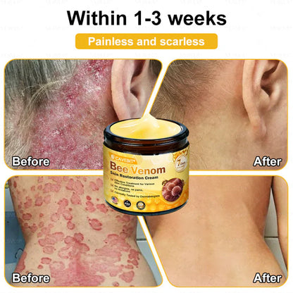 💐 Cavebit® Bee Venom Cream – Fast Skin Repair | Made in USA | 80% OFF!