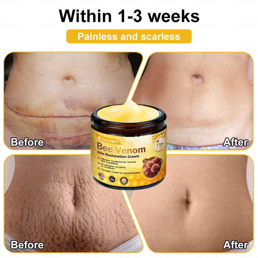 💐 Cavebit® Bee Venom Cream – Fast Skin Repair | Made in USA | 80% OFF!