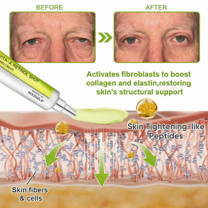 ✨Final 3 Hours: 70%OFF🔥Acezozla™ Botulinum & Vita-A Retinol Shot Wrinkle-Lift Tightening cream✨